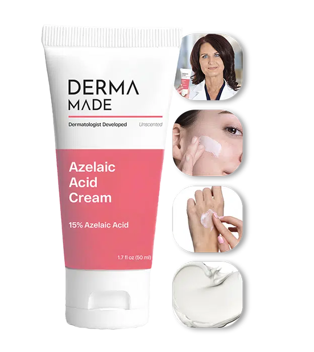 Azelaic Acid Cream